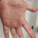 닥터바라센스 | 의사가 만든 Y존 케어, 닥터바라센스 겔타입 여성 에센스 후기