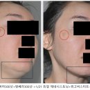 스프링봄봄