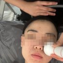 뷰티 썸 스킨 이미지