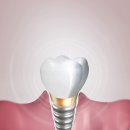 효천이치과의원 이미지