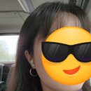 팅커벨 | 요정귀필러 누운귀, 작은귀 엘프귀만들어준다는 팅커벨필러 후기