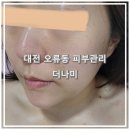 길조 약국 | 대전오류동피부관리 &#34;더나미&#34; 30대 여자 얼굴 물광 피부관리 후기