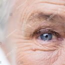 하지정맥류의 치료와 예방 이미지