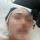 구파발 피부 재생과 리프팅 최강자 [에스제이랩] 후기