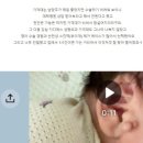 지디에스성형외과 | 신생아 귀앞돌기(스킨텍) 수술, 실제 보호자 후기를 통해 알아보겠습니다