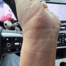 한국한센복지협회울산경남지부마산부설의원 네이버블로그