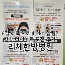 구리 한의원 다이어트 리체인지 해독 프로그램 솔직후기 1탄