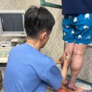 두한성형외과의원 | 알통무다리 드디어 탈출~!