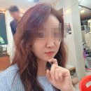 동성로 성형외과 볼뉴머 리프팅 찐 후기
