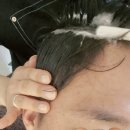 다산 | 다산 두피관리 엠지에프 두피탈모전문센터 다산점 후기