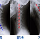 세종 바른 운동 이미지
