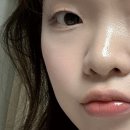 임스헤어 - 안양시 동안구 | 광대 부각 고민이라면? 프리티앵글 광대축소기 사용후기