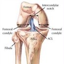 전방십자인대파열 치료방법을 알아봅시다! 이미지