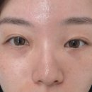 바이소 | BEAUTY｜원주 반곡동 속눈썹 전문＂바이소야＂임산부 속눈썹펌 후기