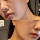왕십리 에스테틱 약손명가 동안얼굴관리 후기