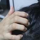 서울대 탈모토닉으로 두피루틴 바꾸기ㅣ올솔 맥주효모 줄기세포 노틱 사용후기!!