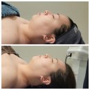 피부맑음 | 명동 웨딩관리 추천 &#39;서윤피부맑음&#39; 얼굴축소, 울쎄라 리프팅 관리 후기