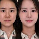 순이살롱 - 화성시 | 영등포 여의도 하객 데일리메이크업 대만족 후기 넘치는 민낯살롱