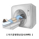 아킬레스 건염[Achilles' tendonitis근골격질환] 이미지