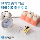 이-아트치과기공소 | 수지구치과 단계별 충치 치료 빠를수록 좋은 이유
