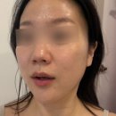 하로스파 이미지