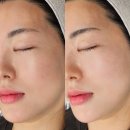 노브랜드 김포풍무점 | 김포 고촌 기미 주근깨 피부미백관리 클리어스팟으로 잡티관리 후기