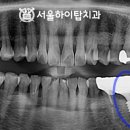 서울하이탑치과의원 이미지
