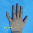 강남챔피언정형외과의원 이미지