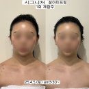 설아미 | 설아미 의정부본점 의정부피부관리 윤곽관리로 만족했던 프리미엄 케어 후기