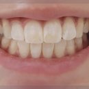 (주)경일통상 | 라미네이트치과 케이스를 보고 결정하기