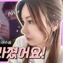 아베크 성형외과의원 이미지