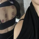 부산 잡티제거피부과 기미색소 컨택터 후기