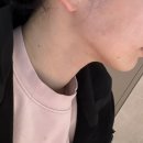 글로비지테라안티에이징의원 | 압구정 피부관리 글로비 지테라 안티에이징 의원 역대급 윤곽 리프팅 (feat. 크레이지015)