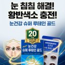 스마트폰으로 보는 세상 | 내돈 내산 : “충격” 스마트폰 보는 사람 90% 모르는 눈 망가지는 이유