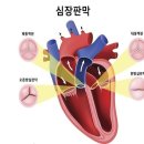 갑자기 숨쉬기 어려워요".. 심장 판막 질환, 어떻게 진단하고 치료할까? 이미지