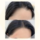 리엠헤어 이미지