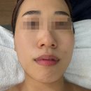 풍영로101번길풍영로145번길 | 광주 수완지구 피부관리 잘하는곳 펄미에이트에서 모공관리 받고 온 후기
