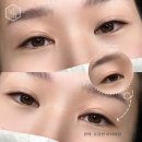 미샵 이미지