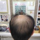수진동미용실 셀모가발미용실 아이롱파마스타일로 가발맞춤했어요