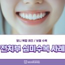 위드미치과의원 | 광안리 위드미치과, 전치부 심미수복은 이렇게!!