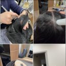 탑 솔루션 | 안양탈모 고민 해결! 탑스칼프 안양점에서 찾은 두피 건강 솔루션