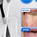 수클리너 이미지