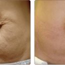 바디프라임 이미지