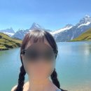 일광약국 | 스위스에서 햇빛 화상, 썬번, 일광화상으로 병원 다녀온 후기