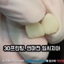 캘리포니아치과기공소 네이버블로그