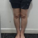 [내돈내산 아치핀 3개월 사용후기]붓는다리와 체형개선에 효과(국가대표선수도 사용한다는 그 제품)