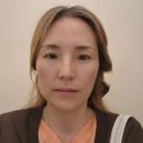 눈꺼풀처짐 수술 및 눈두덩이 지방이식 원진성형외과 눈성형상담 후기