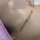 림스플래닝