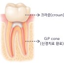 위드미치과의원 | 용이동 위드미 치과 무통 마취, 다수 충치도 덜 두렵게 치료하는 방법