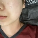 ㈜하얀얼굴예쁜몸매 | 구미 얼굴축소 안면비대칭 신부관리 솔직후기 추천